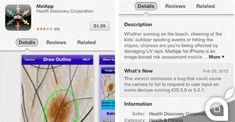 mel app individuazione melanoma