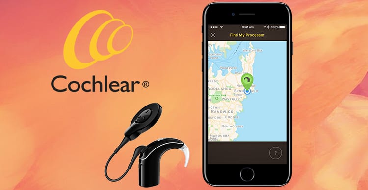 Cochlear