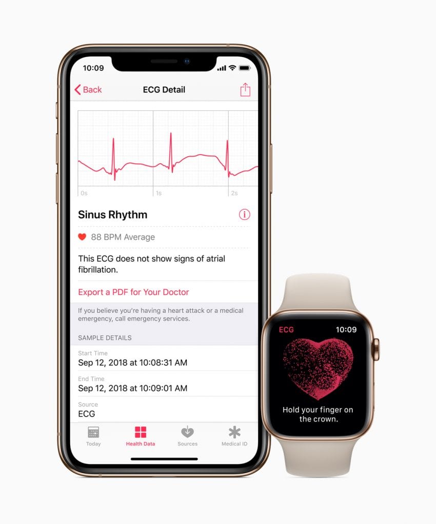 apple watch ecg