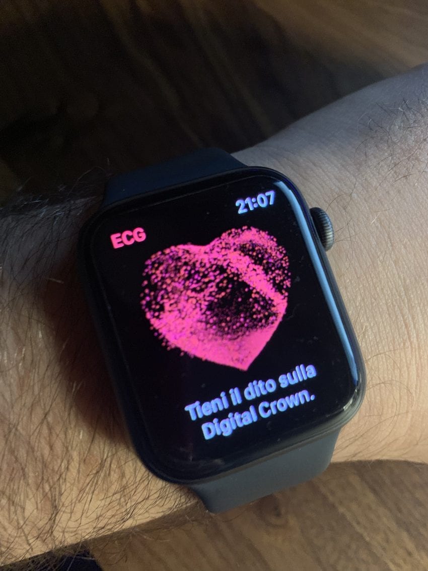 ECG in italiano su Apple Watch