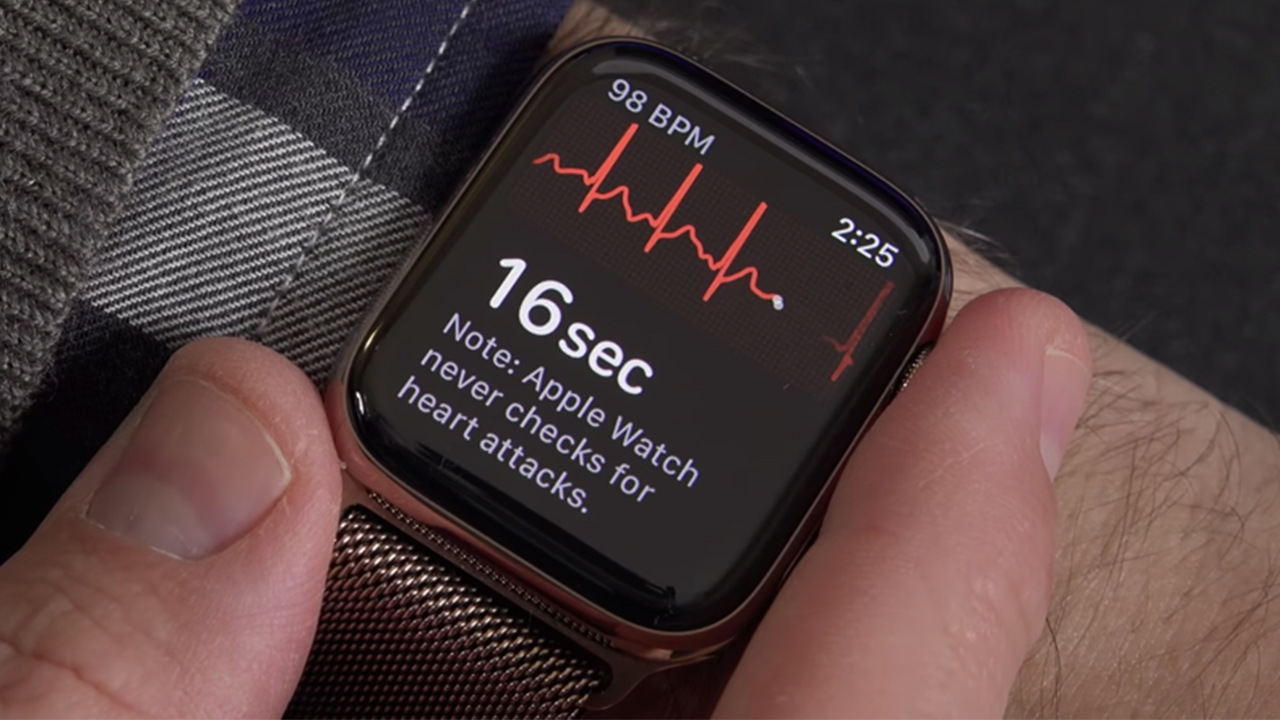 apple watch ecg