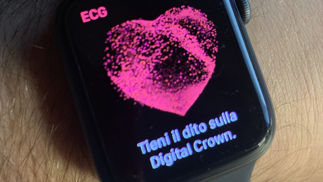 ecg apple watch italia