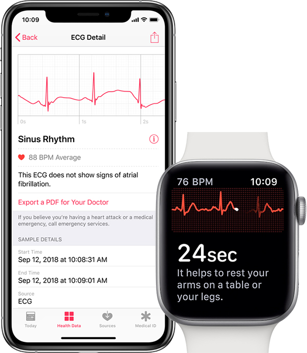 ecg