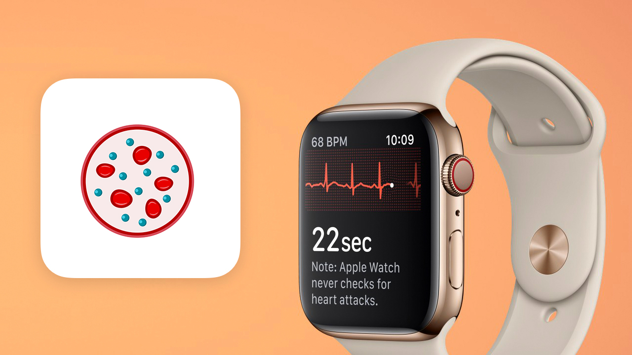 Apple Watch nel 2022 con super sensore in grado di leggere tante informazioni dal sangue